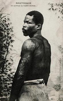 Imagen de Ludger. Wikimedia Commons